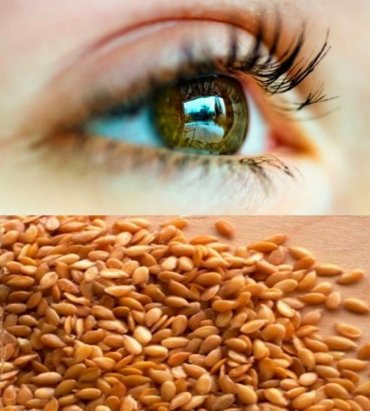 Dry Eyes Flaxseed treatment + management Flaxseed oil for Dry Eyes