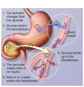 flax for diabetics, flax for diabetes, flaxseed benefits diabetes, flax diabetesl