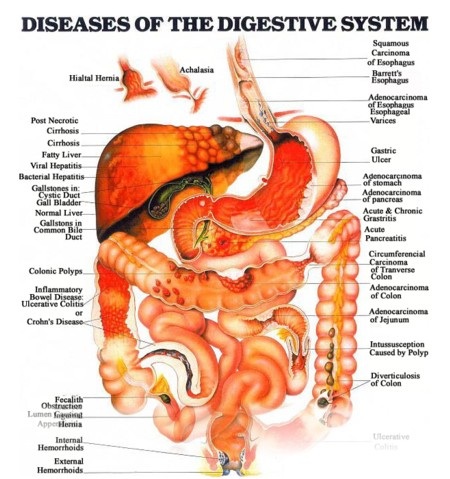 Disease of the Digestive system